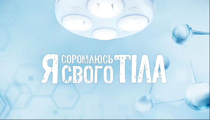 Я стесняюсь своего тела 3